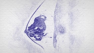 Kompleksowa diagnostyka obrazowa chorób piersi - Entomografia