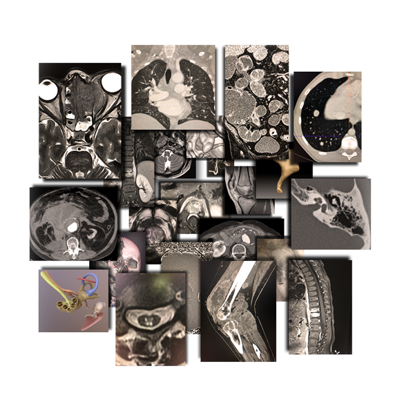 O nas - Entomografia